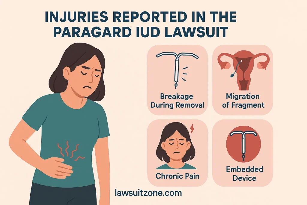 "Illustration showing injuries linked to Paragard IUD including breakage during removal, fragment migration, chronic pain, and embedded device, with branding from lawsuitzone.com."