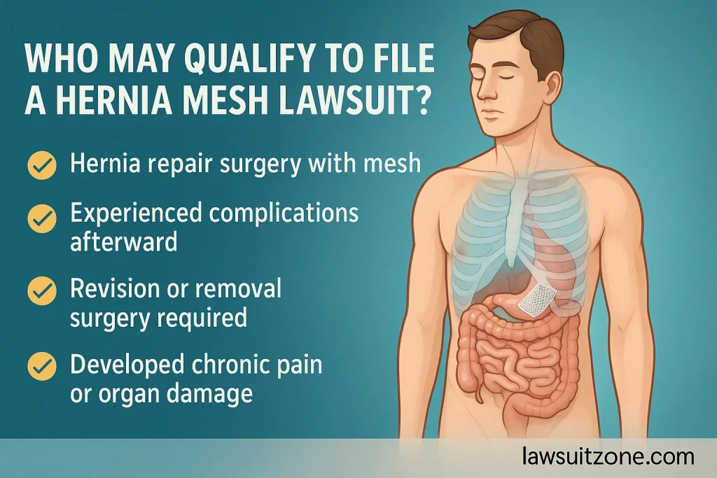 A 2D educational illustration showing a cross-section of the abdominal area with labeled hernia mesh, internal organ, and muscle, designed to visually explain what hernia mesh is. Includes lawsuitzone.com branding.