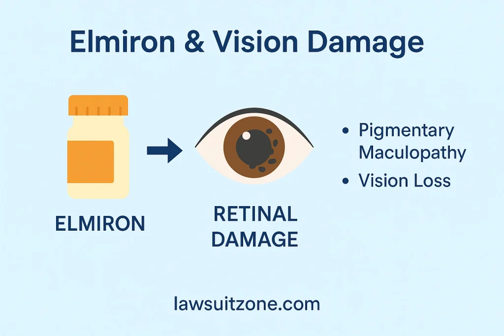 Infographic showing Elmiron vision damage, pigmentary maculopathy, and retinal injury linked to Elmiron lawsuit claims